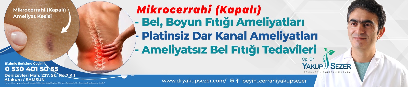 Reklam
